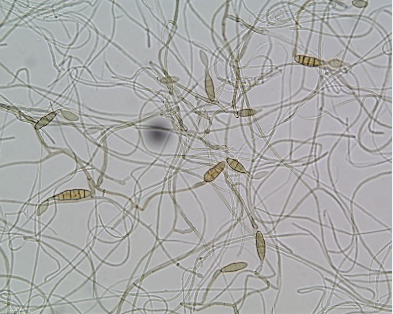 A close up of a microscope image of a spider web.