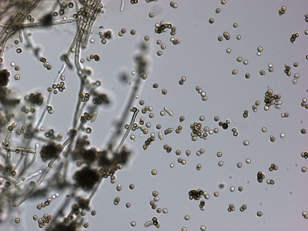 A close up of a mushroom under a microscope.