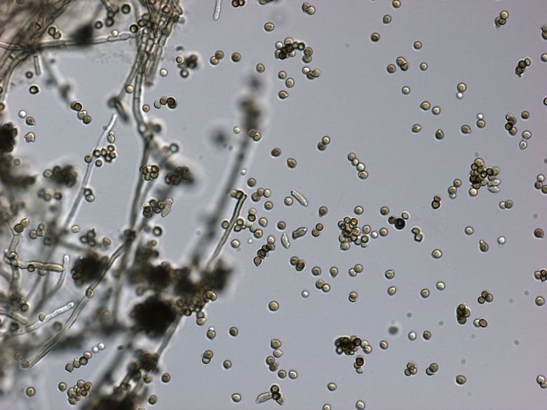 A close up of a mushroom under a microscope.
