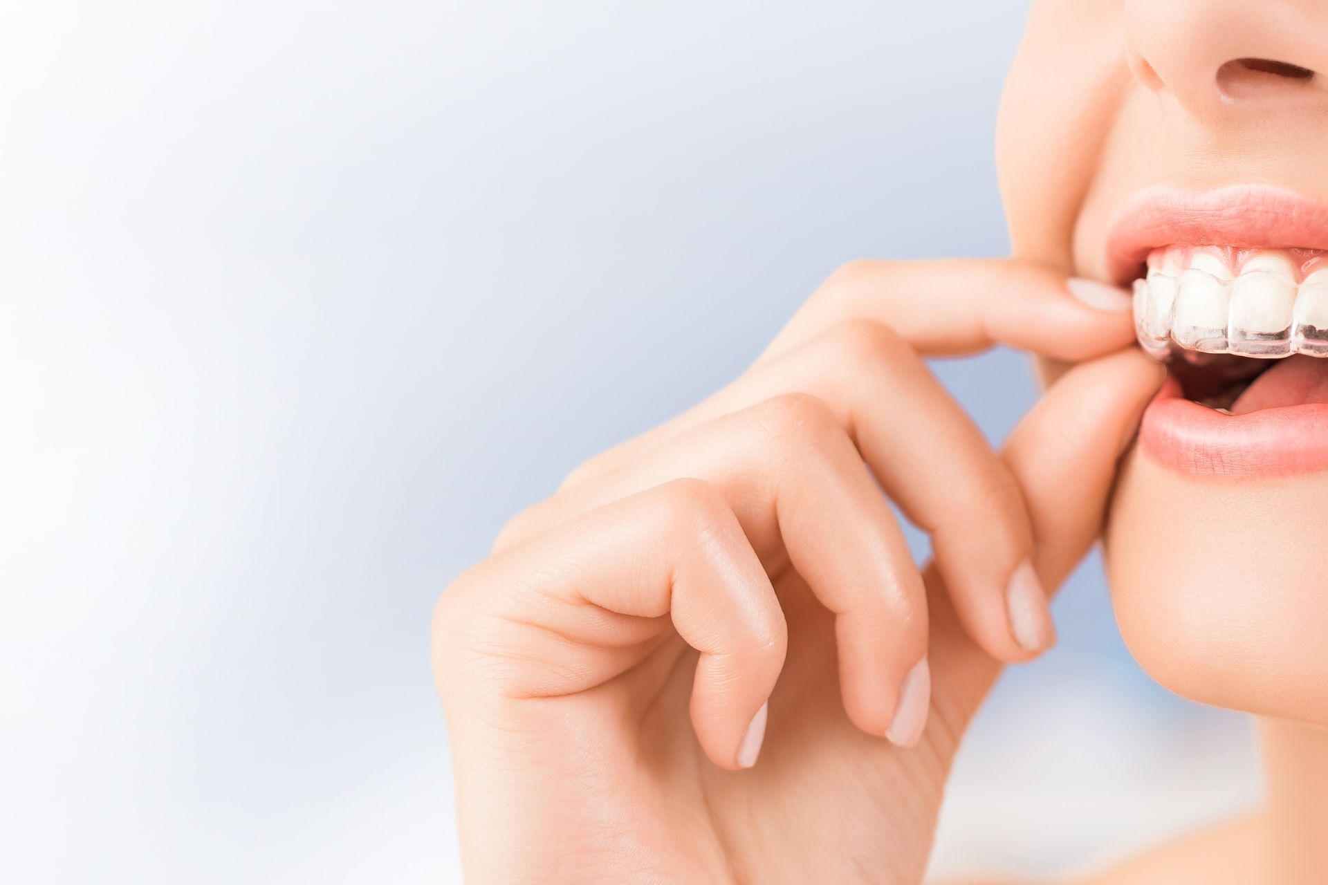 Contact Bellwood Family Dental | Invisalign