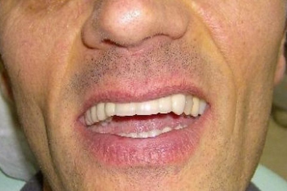 denti curati