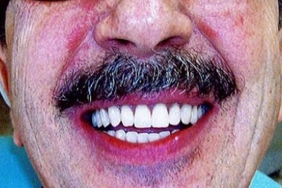 denti bianchi