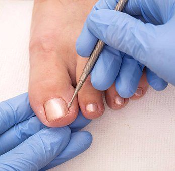 Doctor examines the foot nail before the treatment 