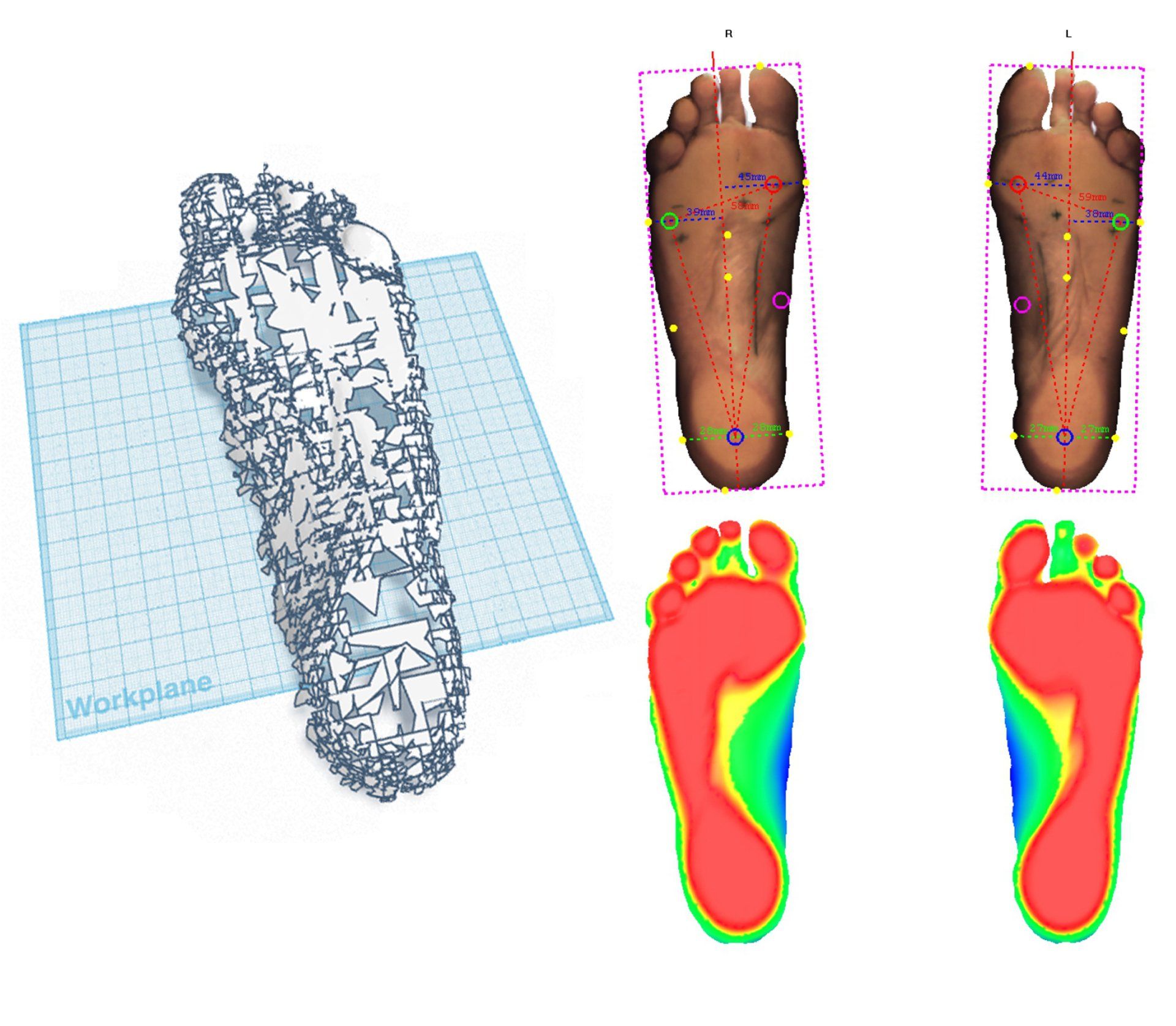 3-dimensional images of the feet