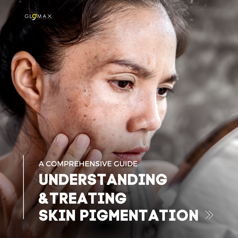 Understanding and Treating Skin Pigmentation: A Comprehensive Guide