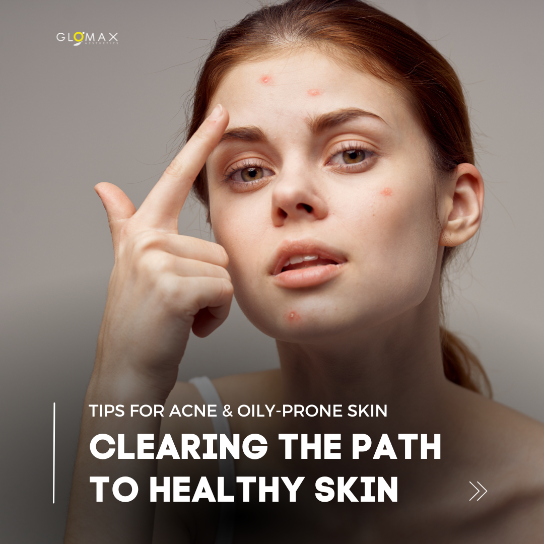 Clearing the Path to Healthy Skin: Tips for Acne Prone Skin