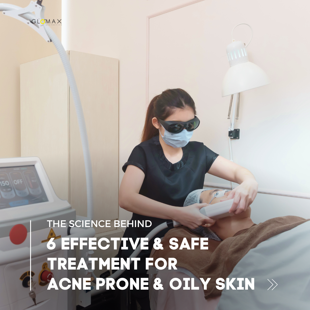 6 Effective & Safe Treatment for acne prone & oily skin