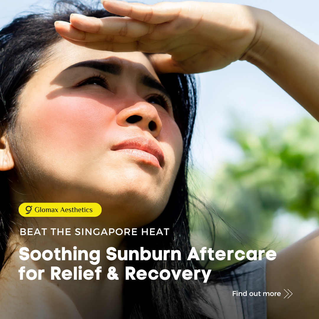 Beat the Singapore Heat: Soothing Sunburn Aftercare for Relief & Recovery