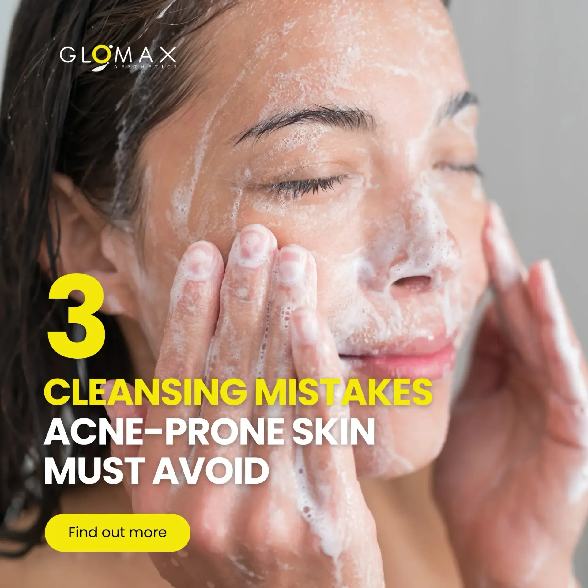 3 Common Cleansing Mistakes Acne-Prone Skin Must Avoid