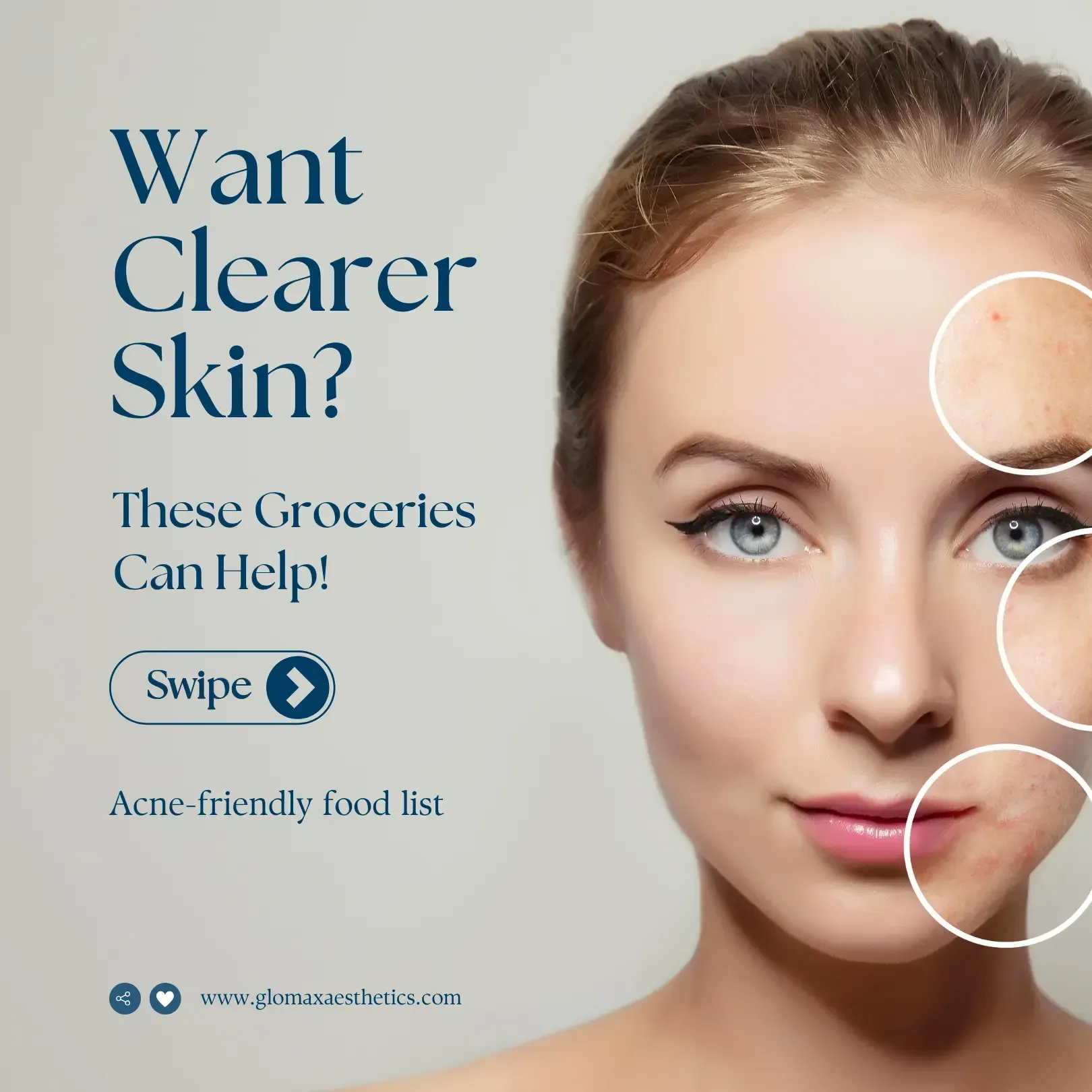 Acne-Friendly Grocery List — What to Buy for Clearer Skin