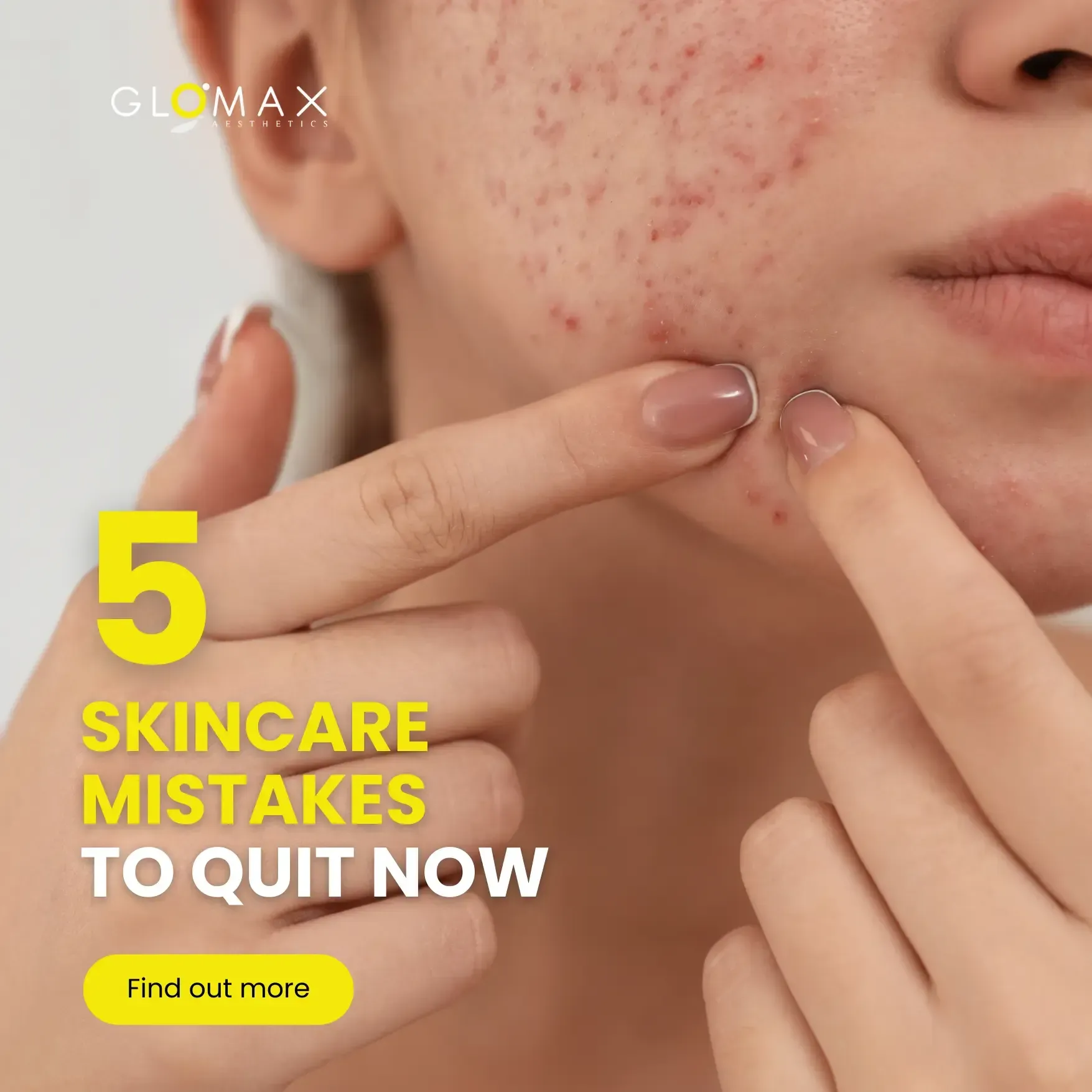 5 Skincare Mistakes to Quit NOW (Beautician Secrets!)