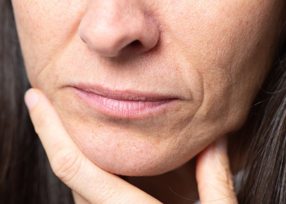 Lip & Lines Treatment York | New Street Clinic