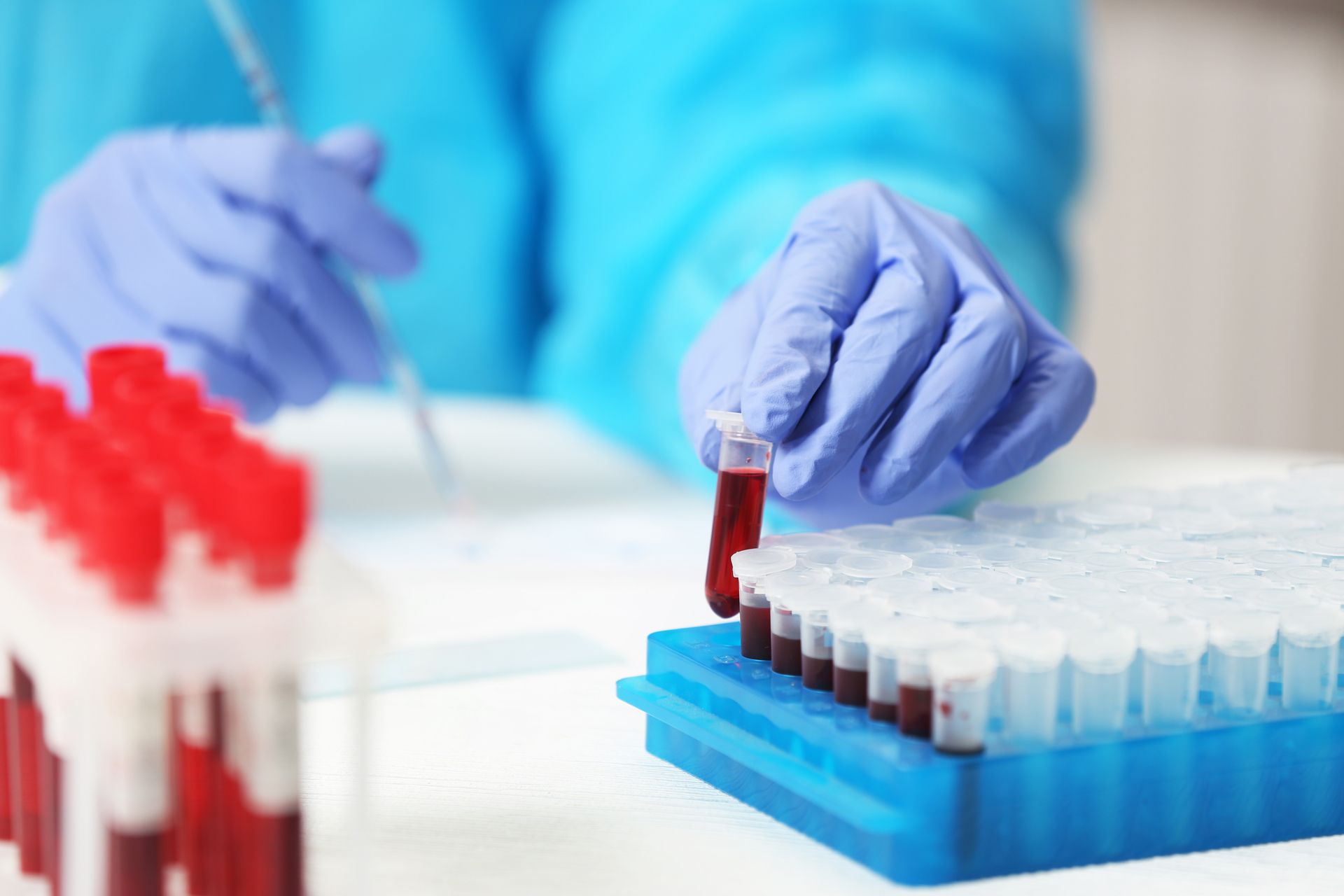 Tnih Lab Test Unlock Your Path To Better Health: How Lab Tests Skyrocket Your ...