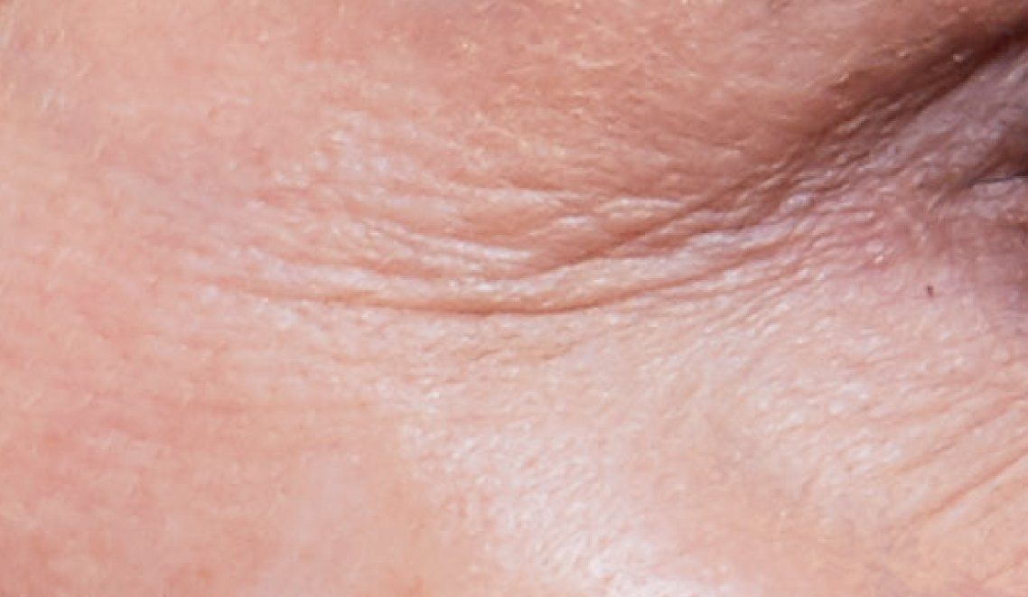 anteage progress picture