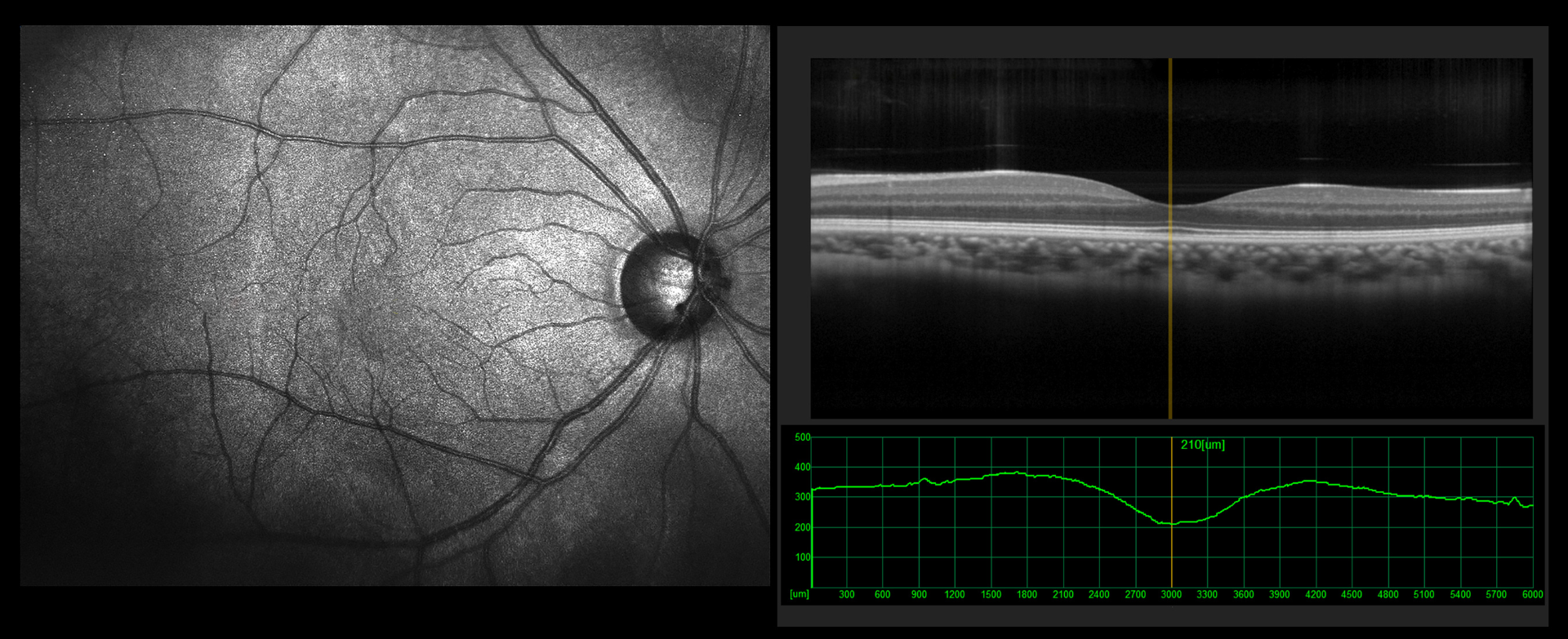 What Is Ophthalmic Image Management Software?