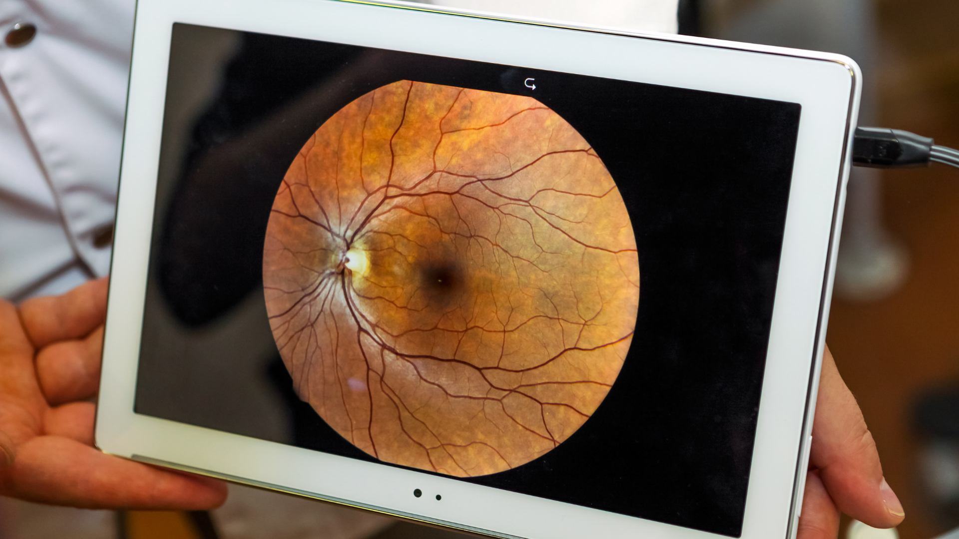 Get the Best Ophthalmic Image Management Software With OphthalmologyEHR