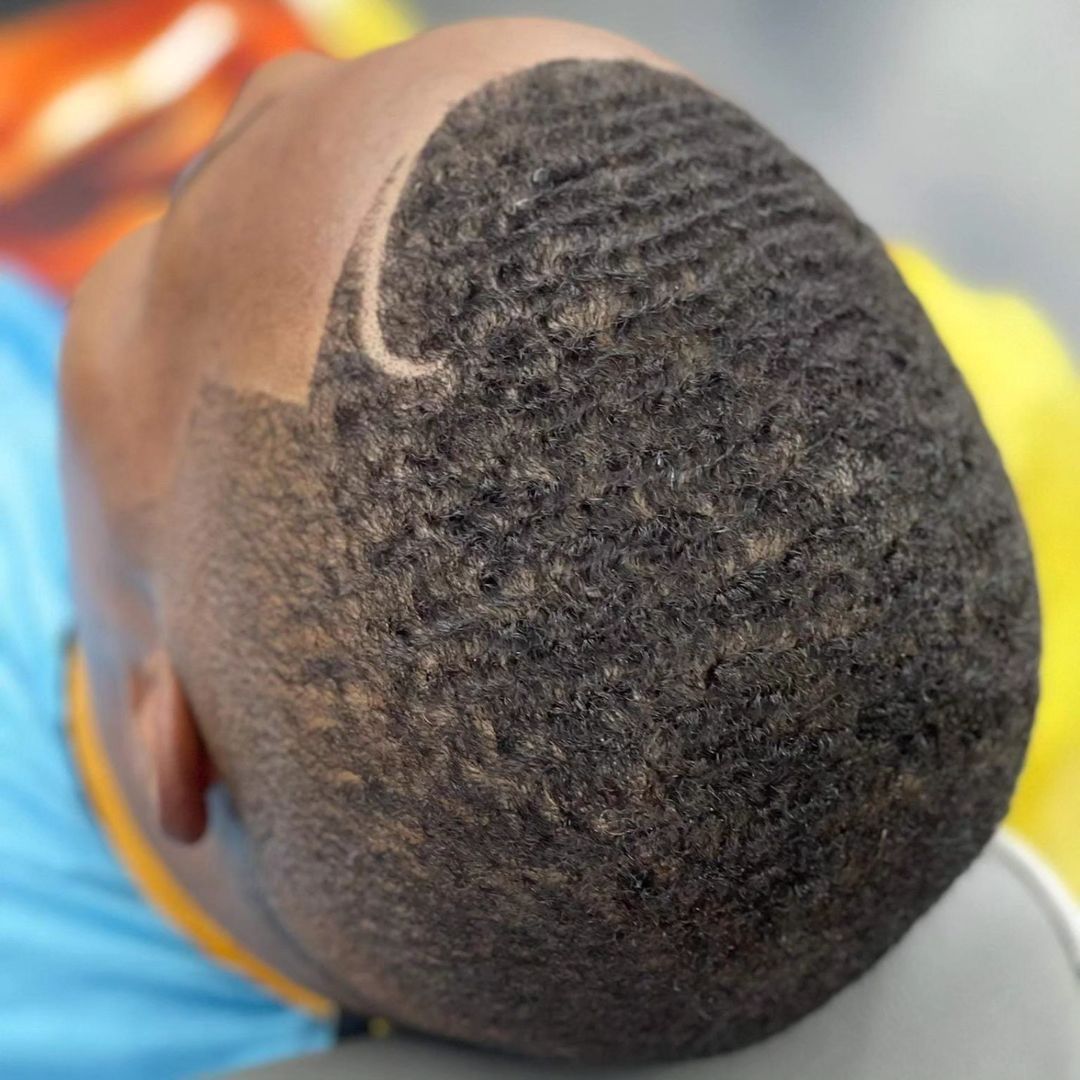A close up of a person 's head with a blue shirt on
