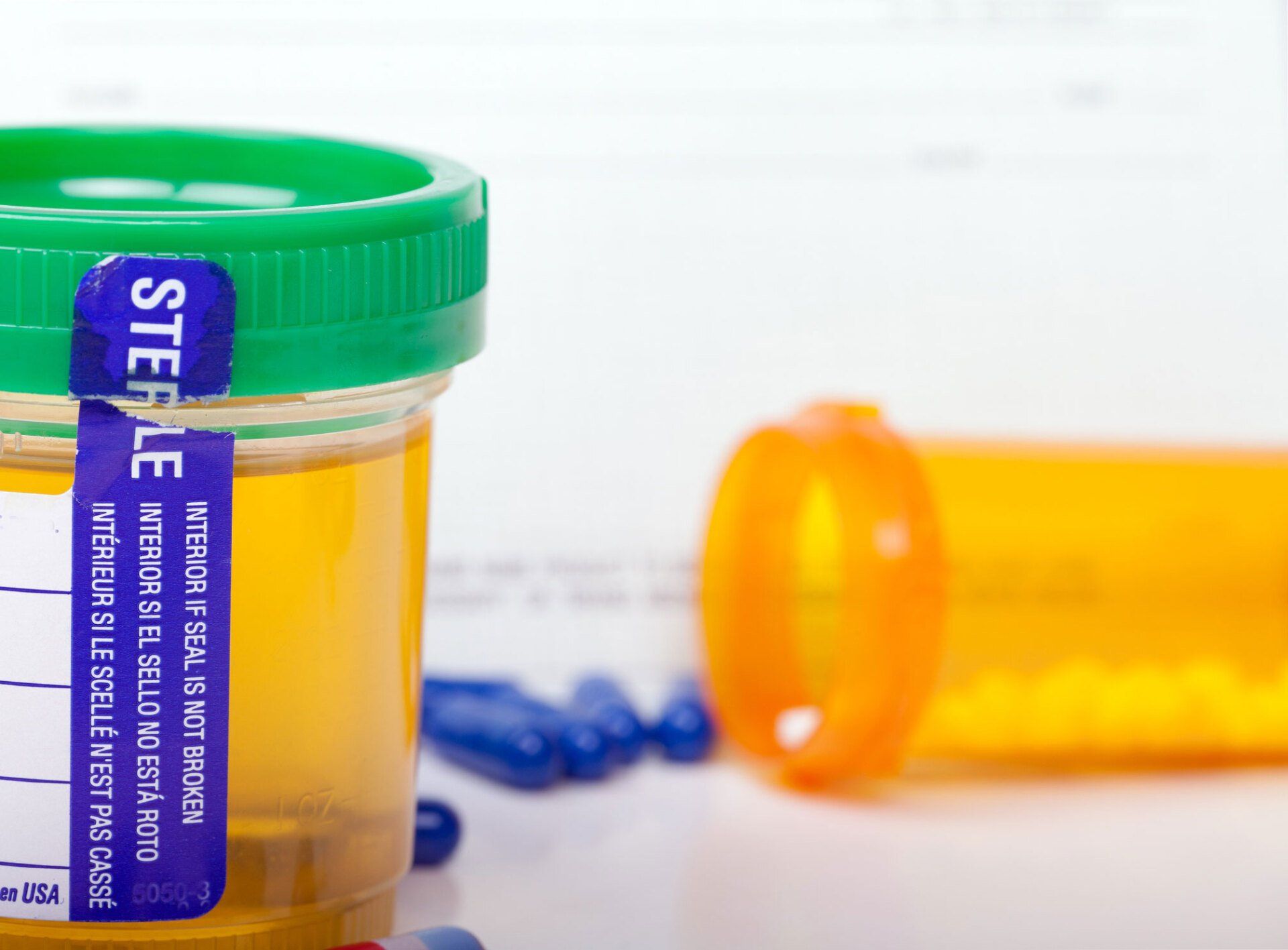 Sterile Urine Test — Oklahoma City, OK — Specialized Outpatient Services