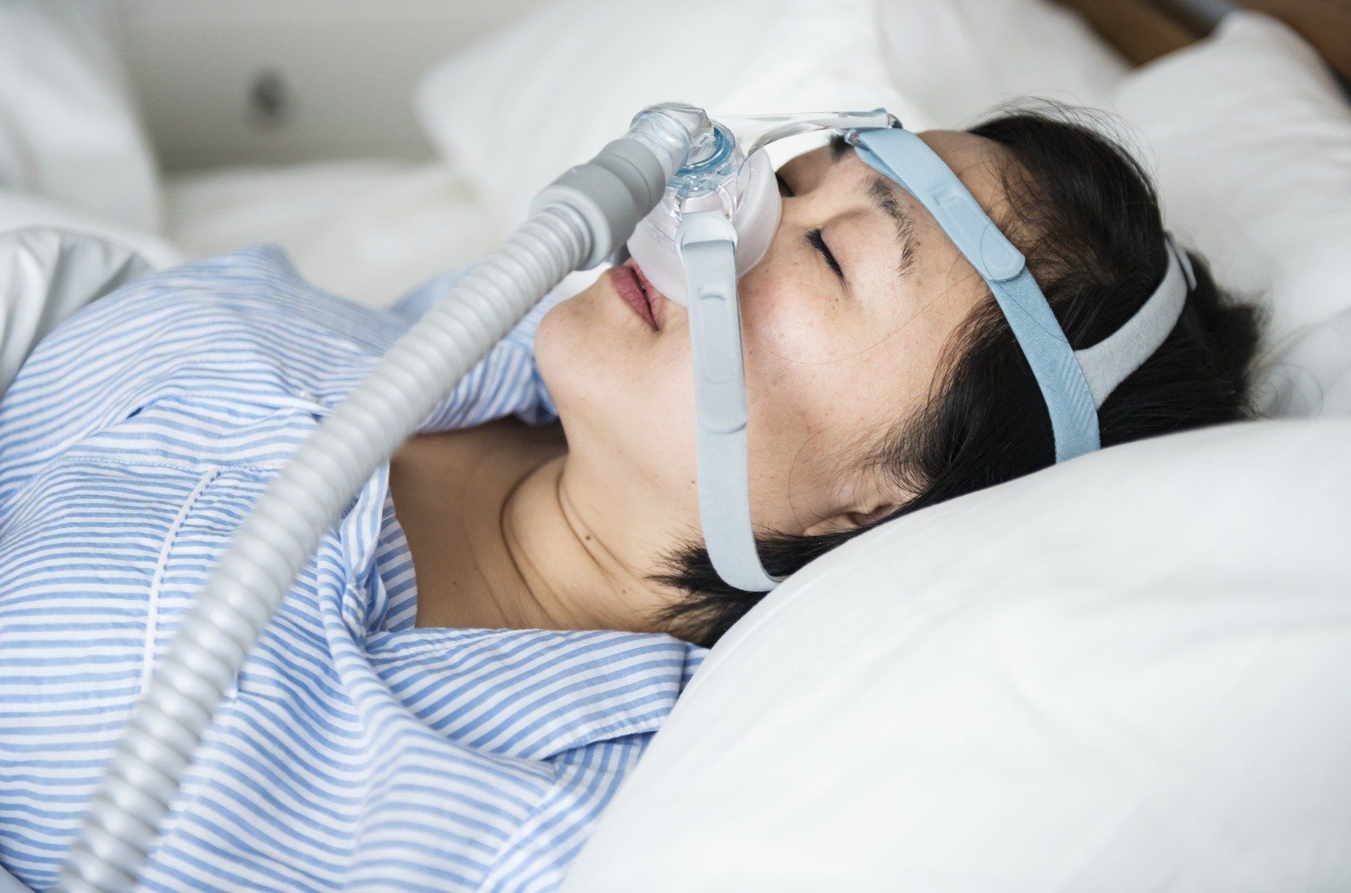 Sleep Apnea Treatment Without CPAP