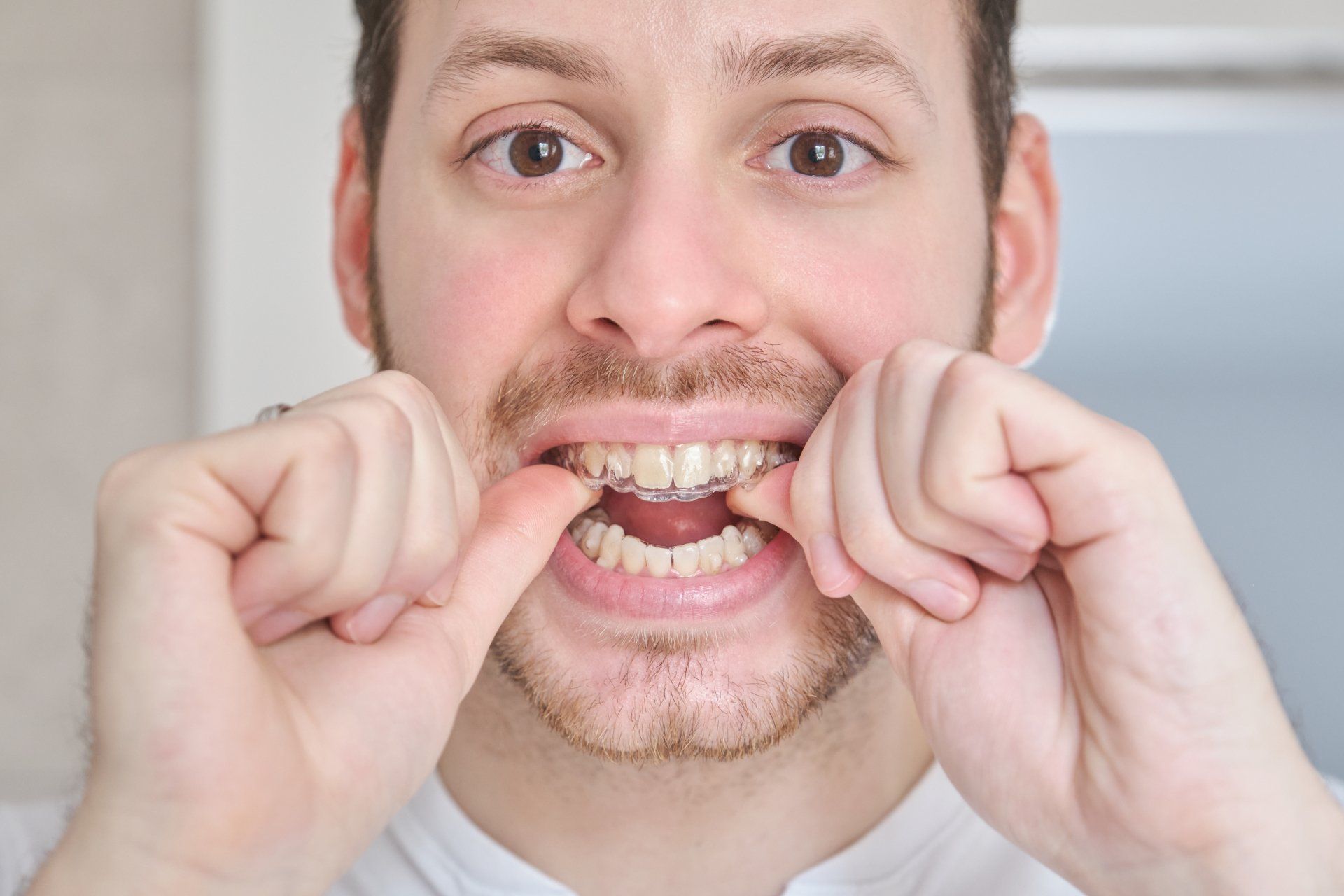 Benefits Of An Oral Appliance For Sleep Apnea Sleep Advantage