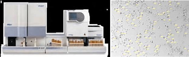 Stick per l'esame delle urine