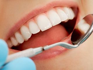 Dental work designed to improve your smile 1