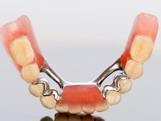 Dental work designed to improve your smile 3