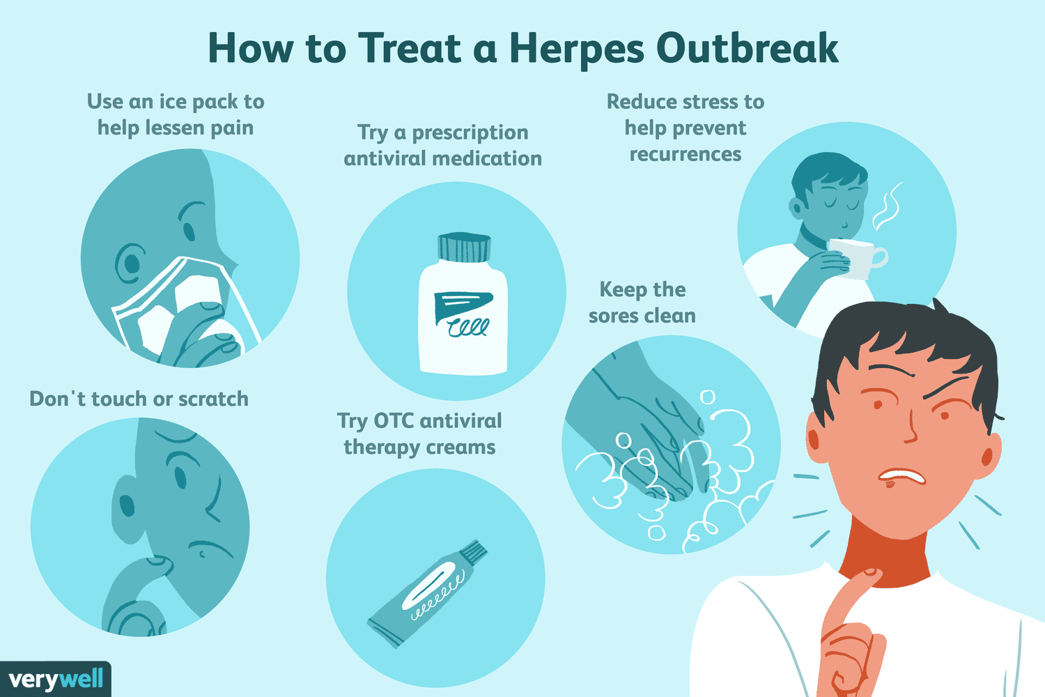 Treating herpes