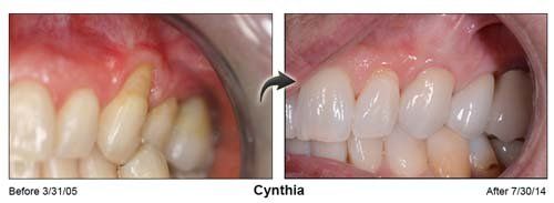 Patient Dental Care — Cynthia Teeth And Gums in Cleveland, OH