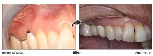 Family Orthodontic — Ellen Teeth And Gum in Cleveland, OH
