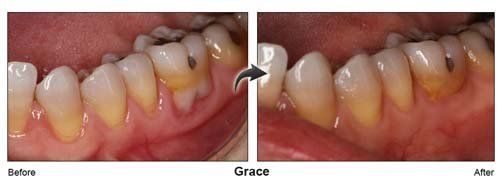 Children Dental Clinic — Grace Gum and Teeth in Cleveland, OH