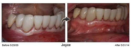 Family Dentist — Joyce Teeth And Gums in Cleveland, OH