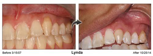 Teeth Expert — Lynda Teeth and Gums in Cleveland, OH