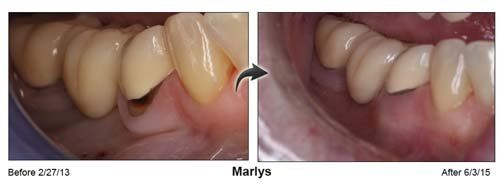 Dental Doctor — Maryls Teeth in Cleveland, OH
