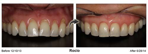 Dental Clinic — Rocio Teeth and Gums in Cleveland, OH