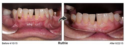Dentist — Ruthie Gum and Teeth in Cleveland, OH