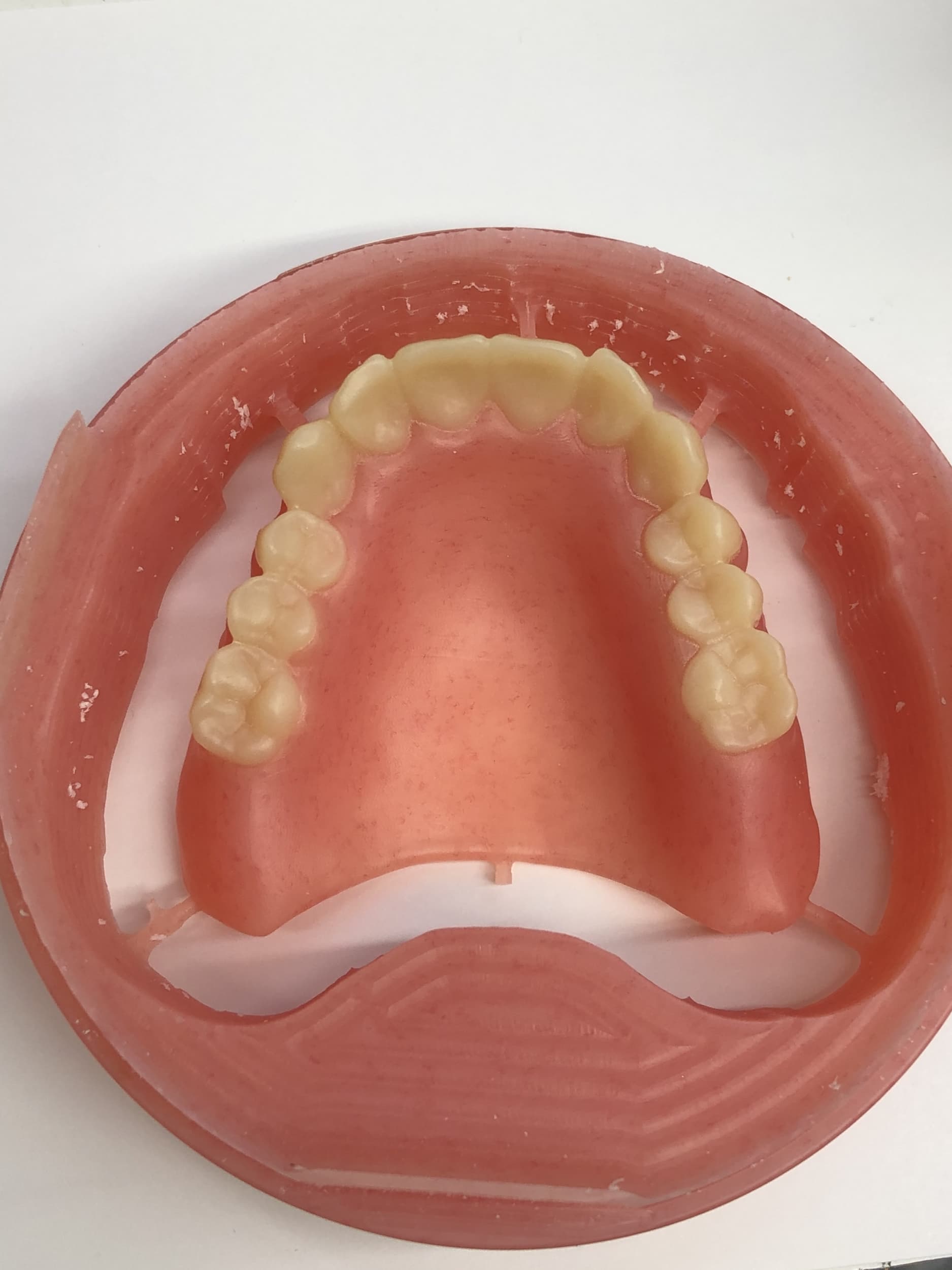 Plastic Denture Of The Jaws — Dental Prosthetics in Labrador, QLD