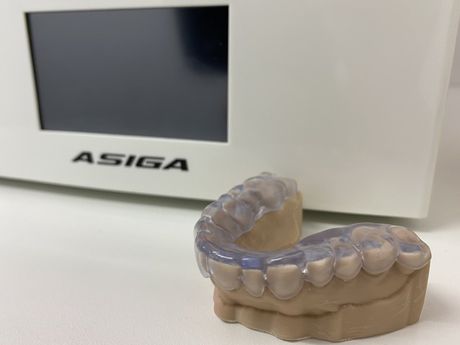 Modern Mouthguard — Dental Prosthetics in Labrador, QLD