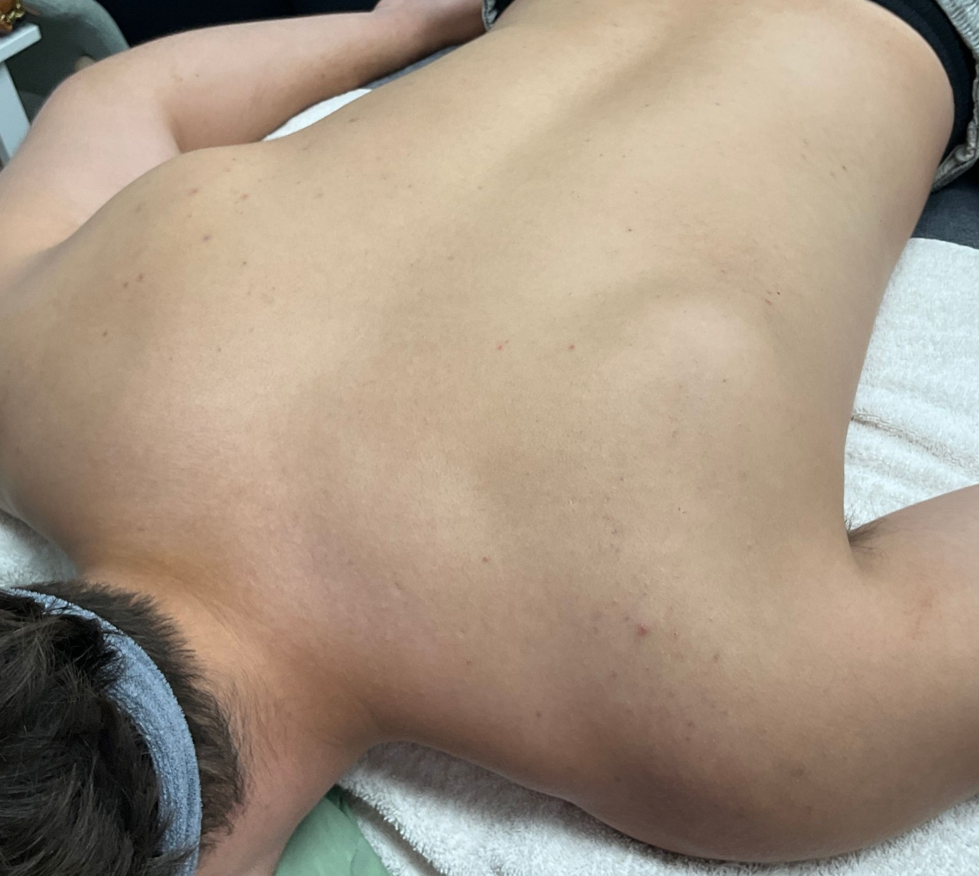 Person lying face down, head to the left, back exposed on a massage table.