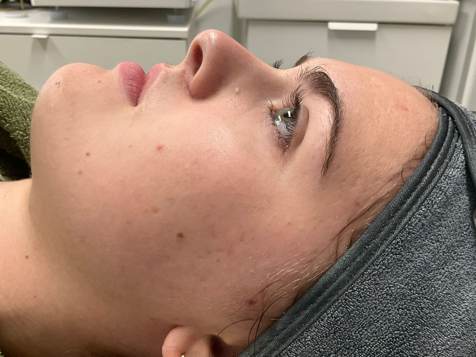 Woman with clear skin and head wrapped in towel, lying down in a clinical setting.