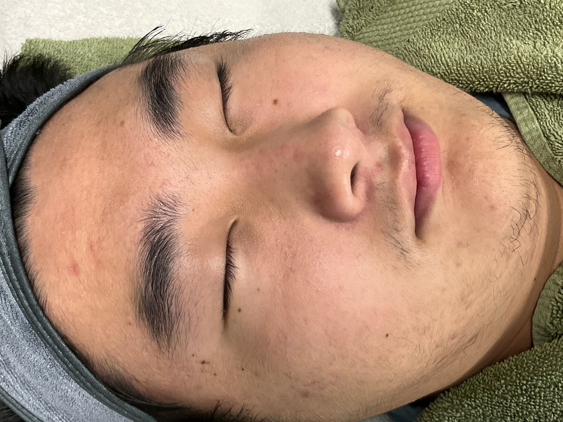 Asian man with eyes closed, lying down with a headband. Skin has slight blemishes.