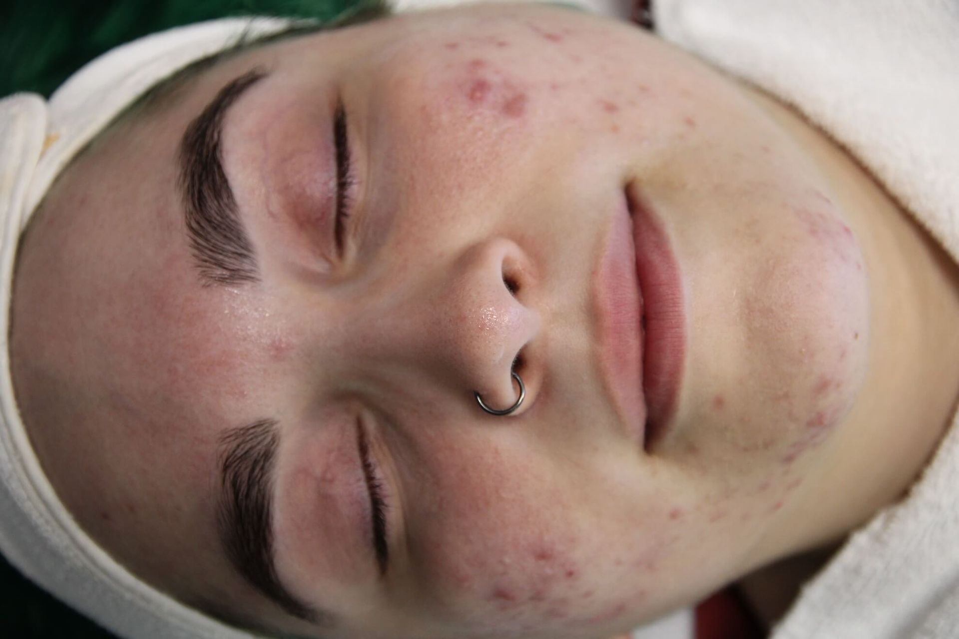 Woman with acne, eyes closed, wearing a headband. Pink skin, nose ring, smiling.