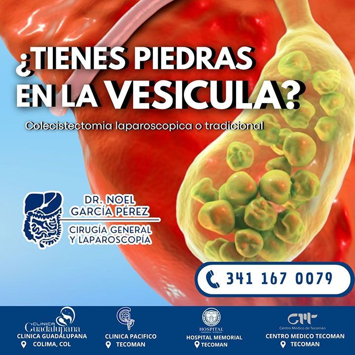 DR NOEL GARCÍA CIRUJANO GENERAL