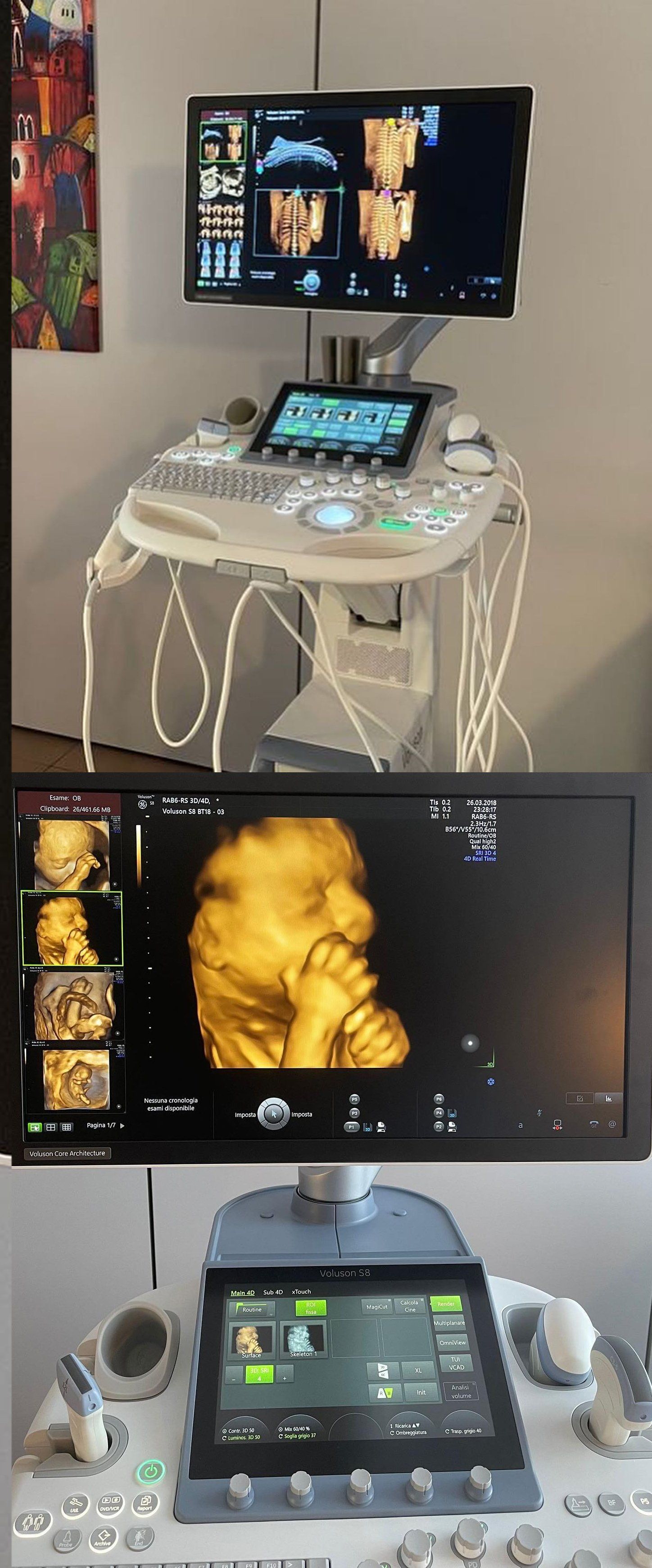 trattamento di tecar terapia