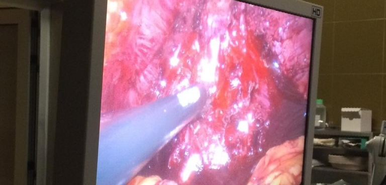 Intervento di urologia