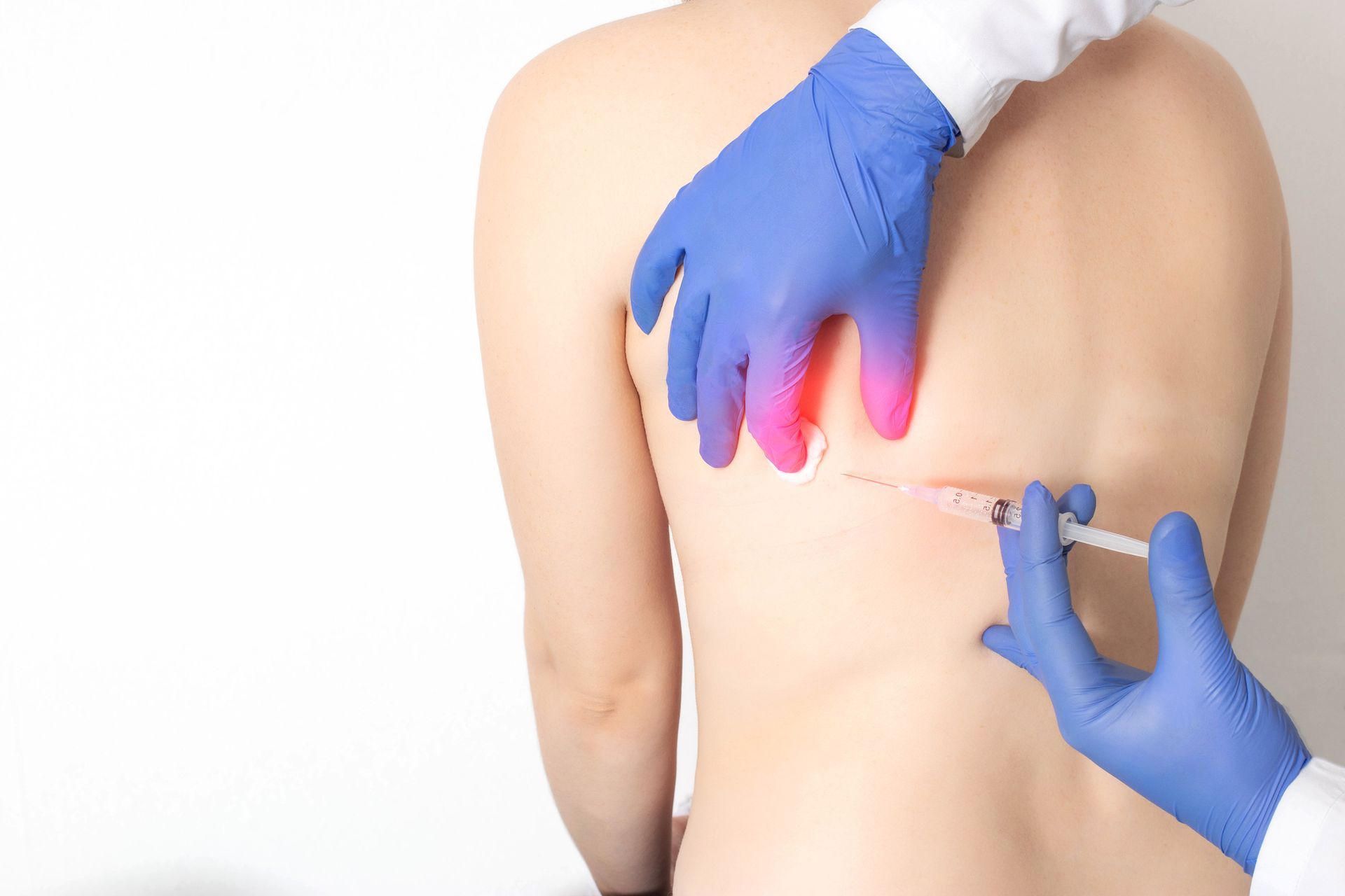 INSUFFLATIVA ENDOVENA