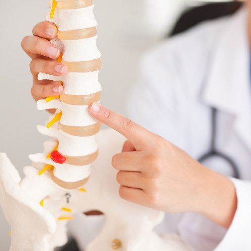 TERAPIA INFILTRATIVA LOCALE