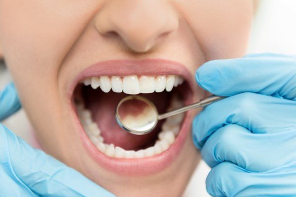 A woman who has had a tooth implant procedure in Campbelltown