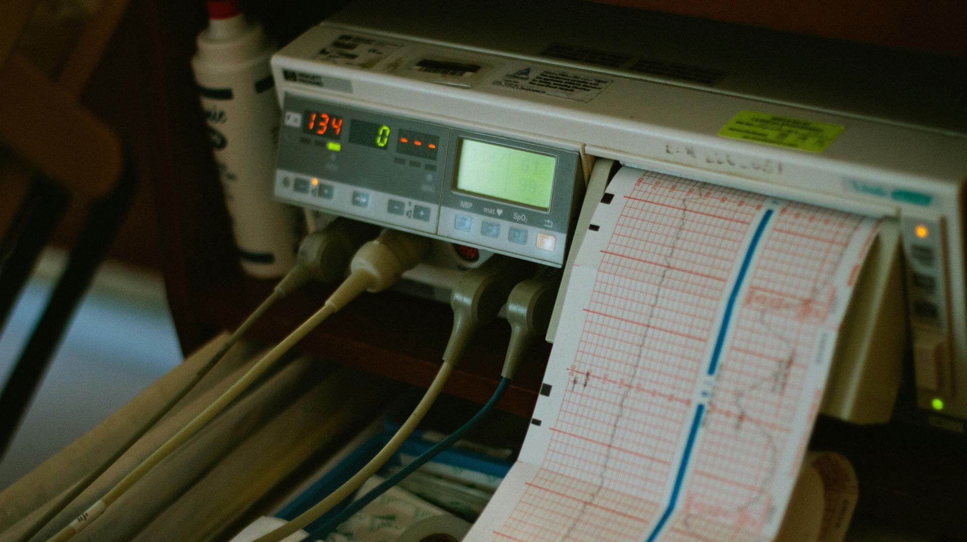 Fetal monitor with attached paper printout displaying heart rate and contractions.