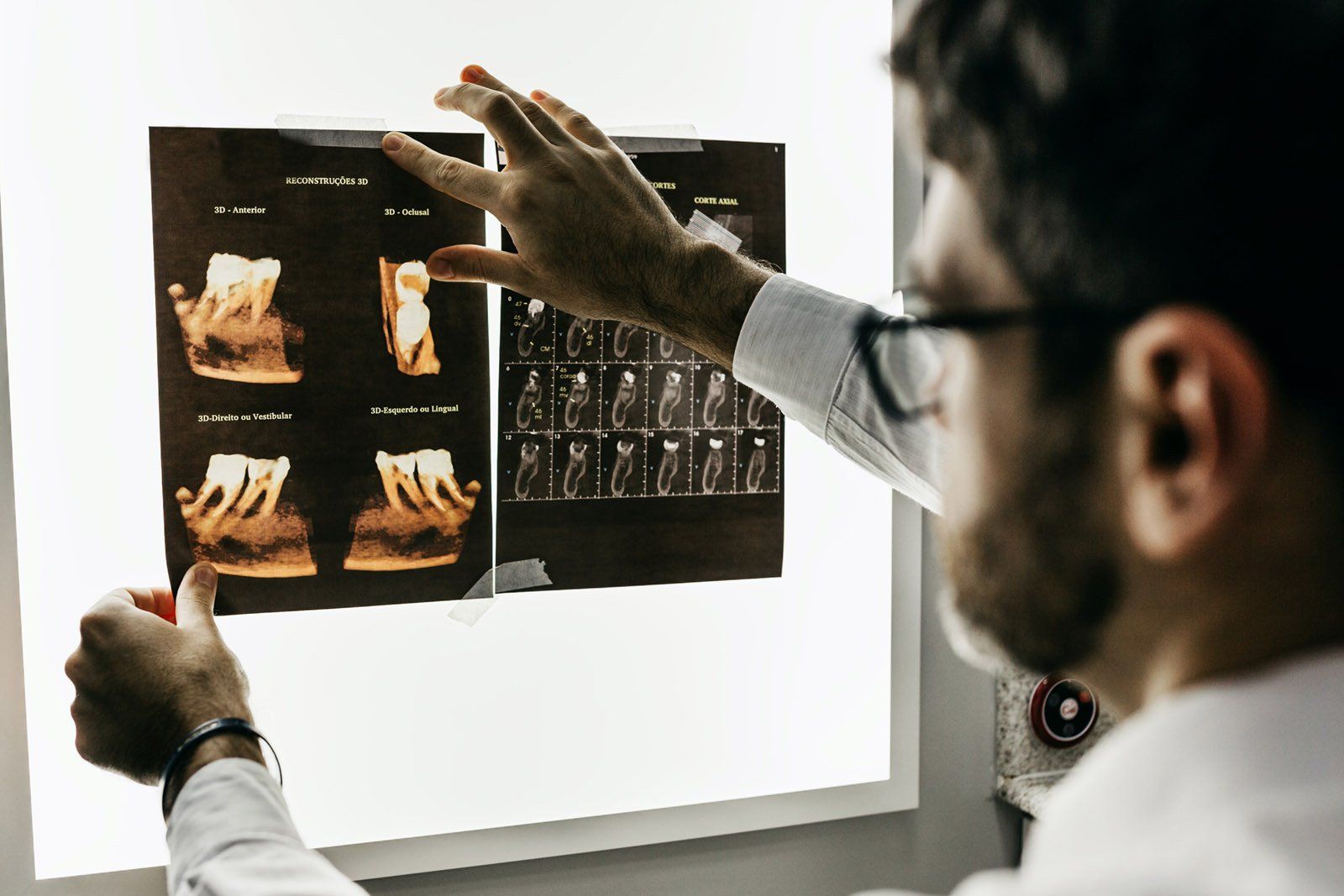 Dentist reviewing CT scan